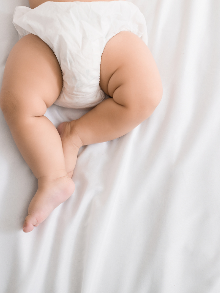 baby with diaper rash
