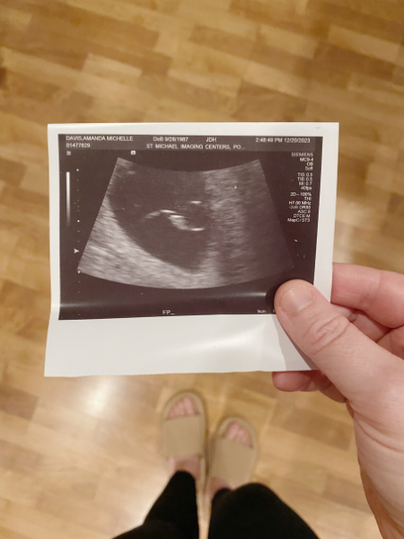 ultrasound and thoughts after miscarriage